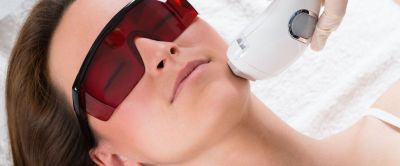 Sprengte blodkar kinn, laser
