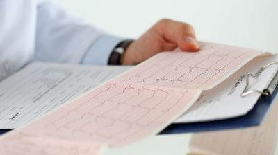 EKG