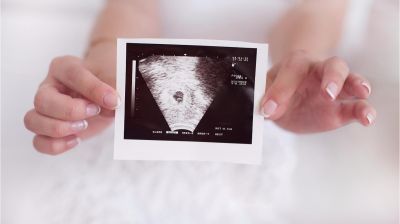 Gynekolog, Tidlig ultralyd eller ultralyd senere i svangerskapet hos Medicus Stavanger