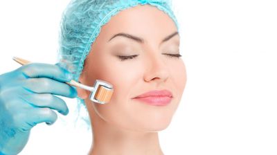 Microneedling