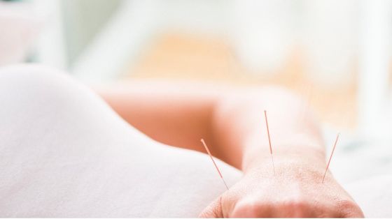 Akupunktur, første behandling
