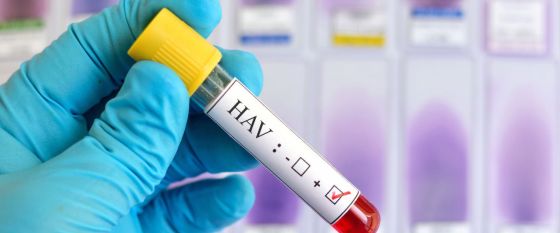 Hepatitt A Hepatitt A