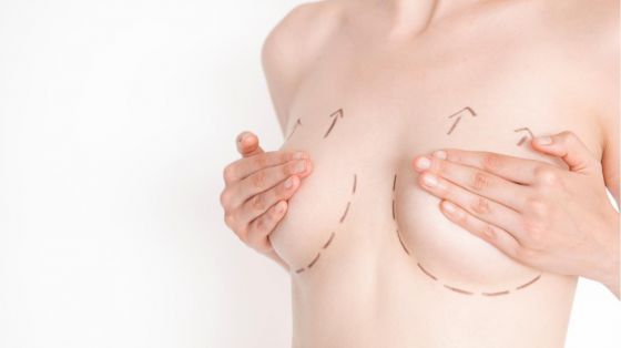 Brystforstørring protese + fett