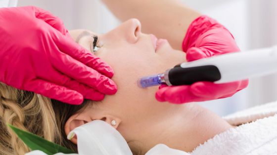 Dermastamp Dermastamp