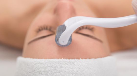 Microneedling oppfølging Microneedling oppfølging