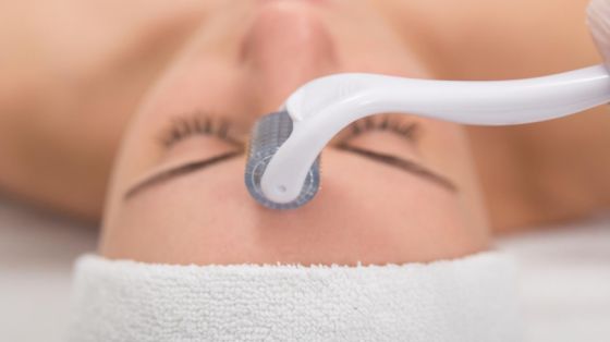 Microneedling oppfølging